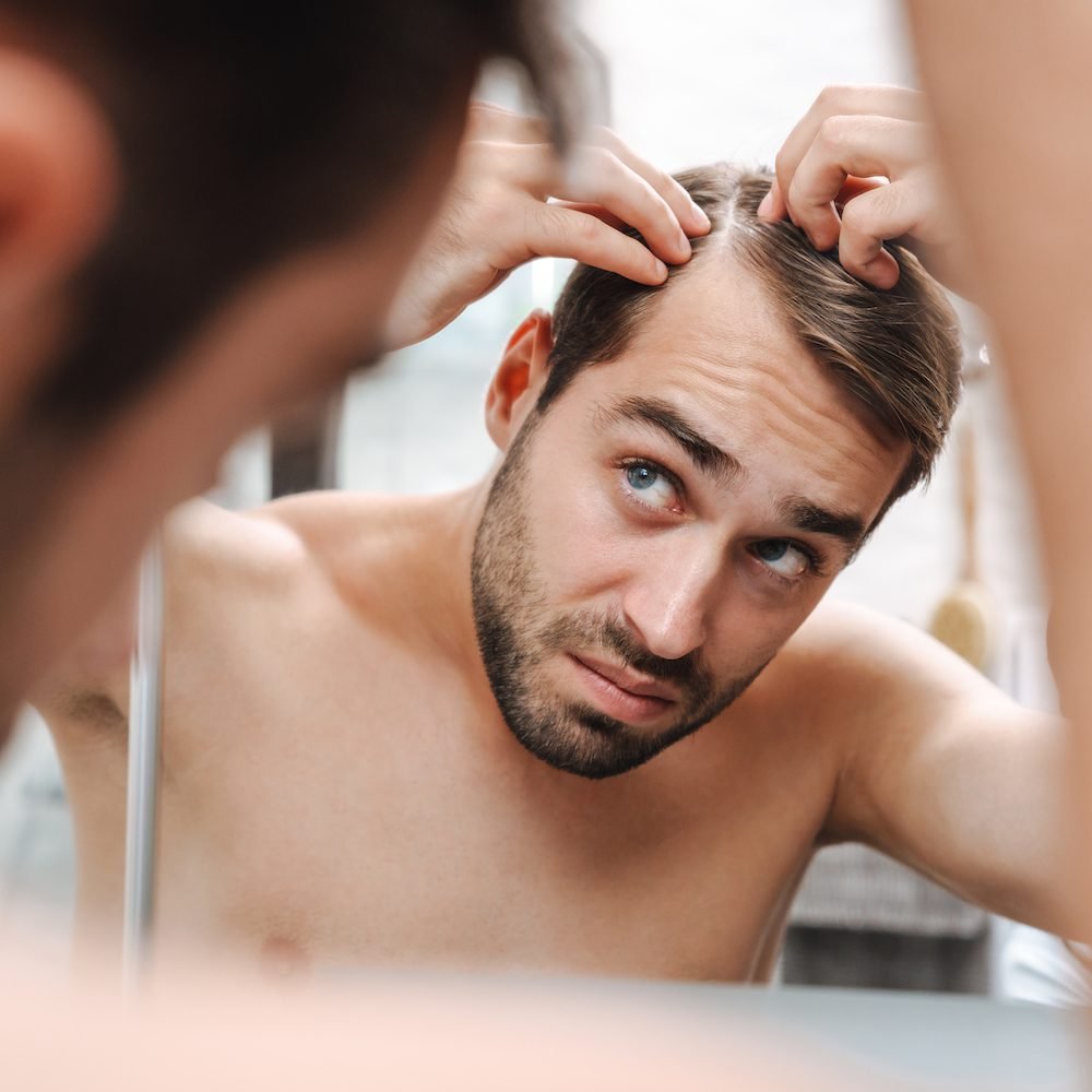 27. Hair loss men