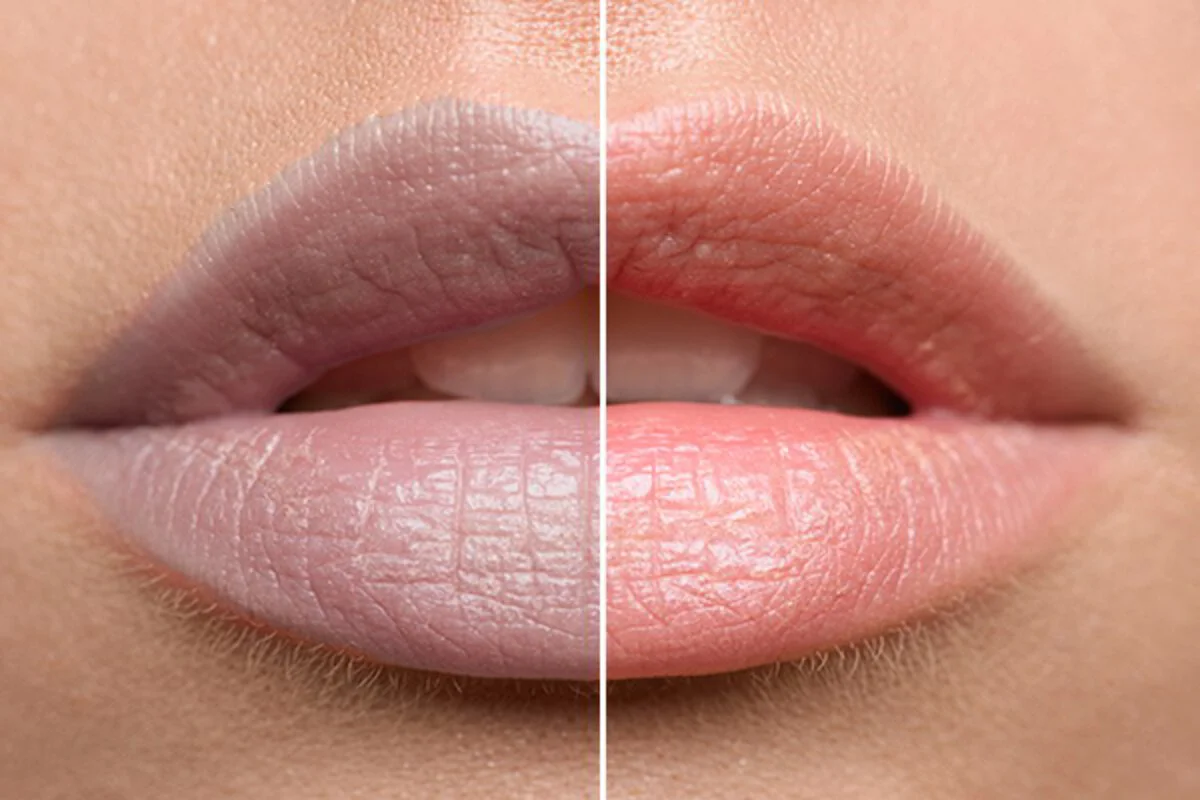 beautiful-lips-istock-1-2383743
